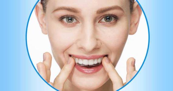 牙齒美白貼片是什么 牙齒美白貼片有幾種類型 牙齒美白貼片是什么 牙齒美白貼片有幾種類型