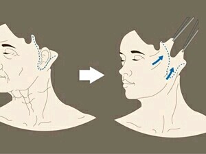 減肥后皮膚會松弛嗎 減肥后怎樣緩解皮膚松弛 減肥后皮膚會松弛嗎 減肥后怎樣緩解皮膚松弛