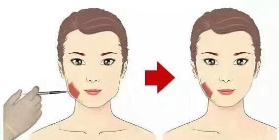 臉胖的原因有哪些 穴位按摩可以瘦臉嗎 臉胖的原因有哪些 穴位按摩可以瘦臉嗎