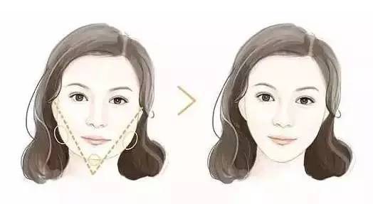 臉胖的原因有哪些 穴位按摩可以瘦臉嗎 臉胖的原因有哪些 穴位按摩可以瘦臉嗎