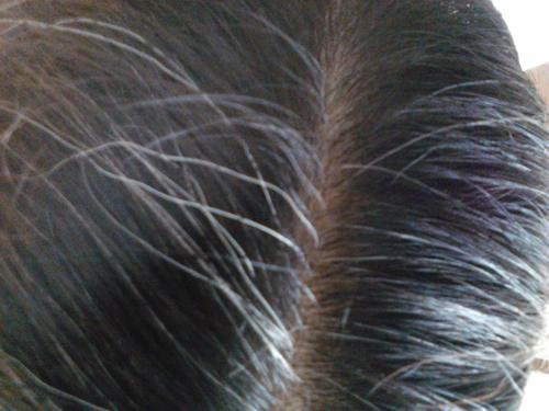 焦慮會長白頭發(fā)嗎 白頭發(fā)如何預(yù)防 焦慮會長白頭發(fā)嗎 白頭發(fā)如何預(yù)防