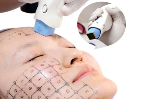 熱瑪吉適合哪些人做 熱瑪吉不適人群 熱瑪吉適合哪些人做 熱瑪吉不適人群