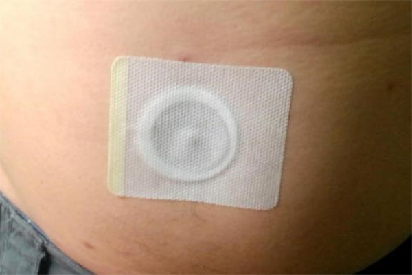 減肥肚臍貼哪個(gè)牌子好 減肥肚臍貼怎么用 減肥肚臍貼哪個(gè)牌子好 減肥肚臍貼怎么用