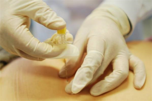 中醫(yī)經(jīng)絡減肥原理 中醫(yī)經(jīng)絡減肥多少次一療程 中醫(yī)經(jīng)絡減肥原理 中醫(yī)經(jīng)絡減肥多少次一療程