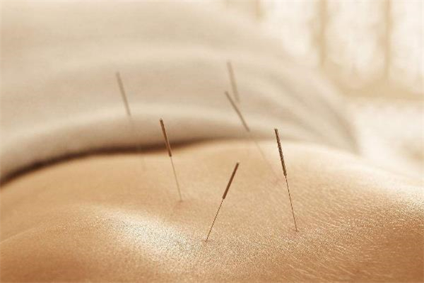 中醫(yī)經(jīng)絡減肥原理 中醫(yī)經(jīng)絡減肥多少次一療程 中醫(yī)經(jīng)絡減肥原理 中醫(yī)經(jīng)絡減肥多少次一療程