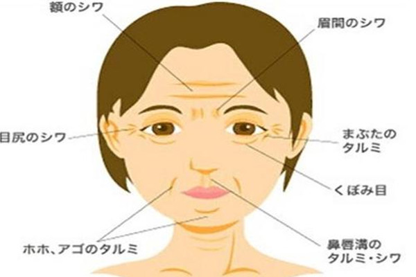 笑紋和魚尾紋的區(qū)別 笑紋只有笑的時候才有嗎 笑紋和魚尾紋的區(qū)別 笑紋只有笑的時候才有嗎