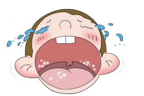 什么是鵝口瘡 鵝口瘡危害大嗎 什么是鵝口瘡 鵝口瘡危害大嗎