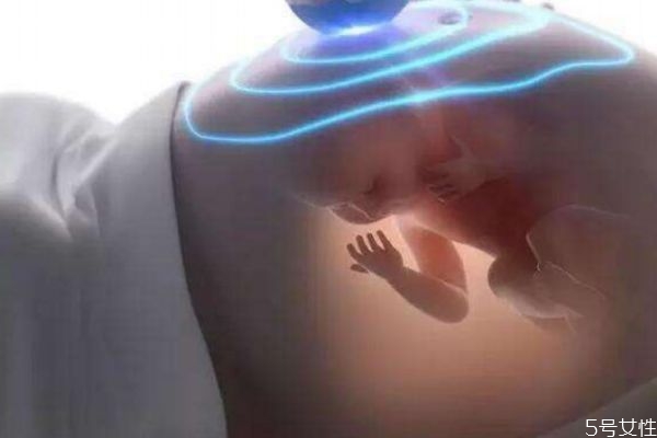 什么是羊膜帶 羊膜帶出現(xiàn)對(duì)孕婦有傷害嗎 什么是羊膜帶 羊膜帶出現(xiàn)對(duì)孕婦有傷害嗎