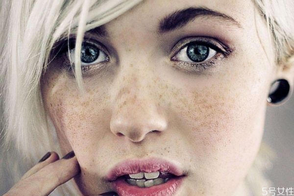 長斑是缺什么維生素 如何消除色斑 長斑是缺什么維生素 如何消除色斑