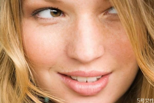 長斑是缺什么維生素 如何消除色斑 長斑是缺什么維生素 如何消除色斑