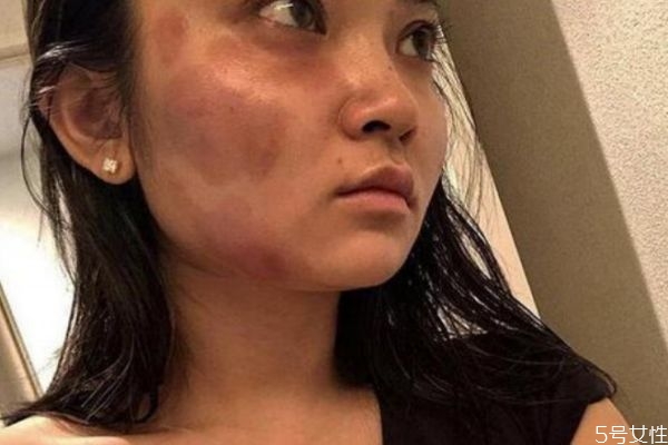 家暴可以容忍嗎 應(yīng)該怎么看待家暴 家暴可以容忍嗎 應(yīng)該怎么看待家暴