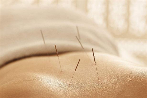 針灸減肥一個(gè)療程能瘦多少斤 針灸減肥一個(gè)療程幾次 針灸減肥一個(gè)療程能瘦多少斤 針灸減肥一個(gè)療程幾次