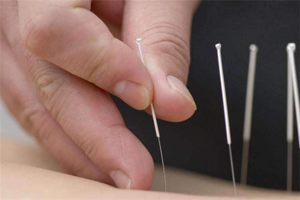 針灸減肥一個(gè)療程能瘦多少斤 針灸減肥一個(gè)療程幾次 針灸減肥一個(gè)療程能瘦多少斤 針灸減肥一個(gè)療程幾次