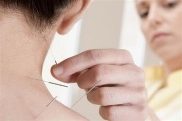 針灸減肥會(huì)影響例假嗎 針灸減肥會(huì)影響懷孕嗎 針灸減肥會(huì)影響例假嗎 針灸減肥會(huì)影響懷孕嗎