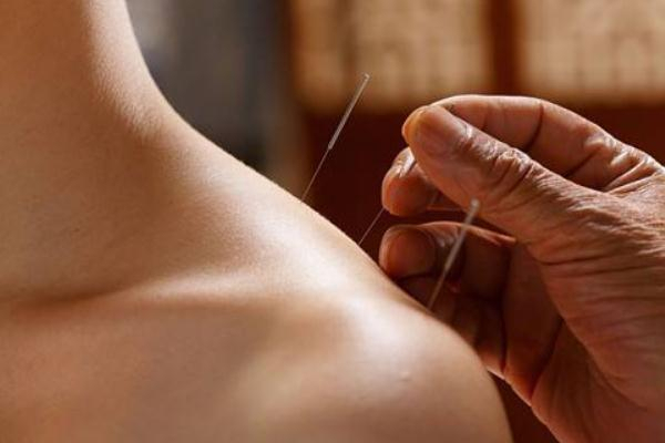針灸減肥適合多大年齡 針灸減肥和埋線減肥的區(qū)別 針灸減肥適合多大年齡 針灸減肥和埋線減肥的區(qū)別