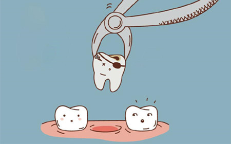 拔牙后能吃冰激凌嗎 拔牙一般會(huì)拔哪種牙 拔牙后能吃冰激凌嗎 拔牙一般會(huì)拔哪種牙