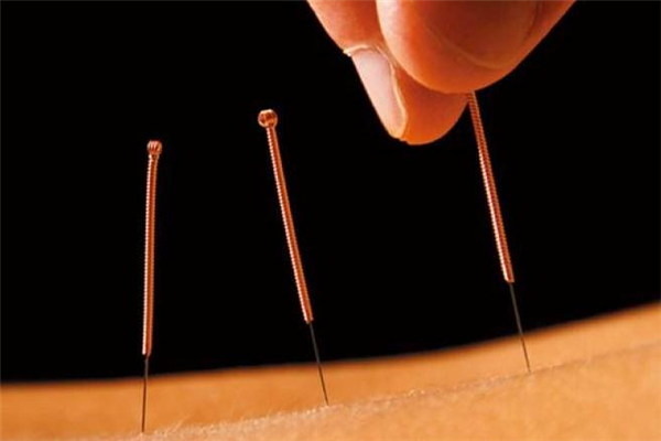 針灸減肥可以抽煙喝酒嗎 針灸減肥如何控制飲食 針灸減肥可以抽煙喝酒嗎 針灸減肥如何控制飲食