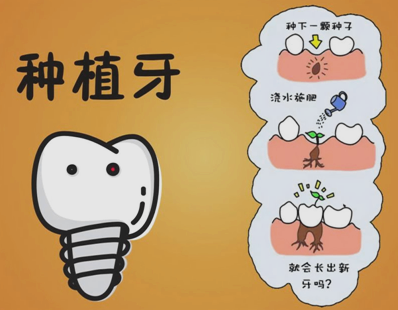 種植牙齒的壽命有多長(zhǎng) 種植牙齒多久能恢復(fù) 種植牙齒的壽命有多長(zhǎng) 種植牙齒多久能恢復(fù)