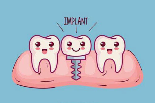 種植牙齒的壽命有多長 種植牙齒多久能恢復(fù) 種植牙齒的壽命有多長 種植牙齒多久能恢復(fù)