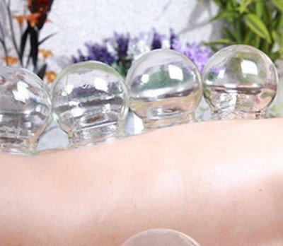 拔罐減肥減的是脂肪嗎 拔罐減肥安全嗎 拔罐減肥減的是脂肪嗎 拔罐減肥安全嗎