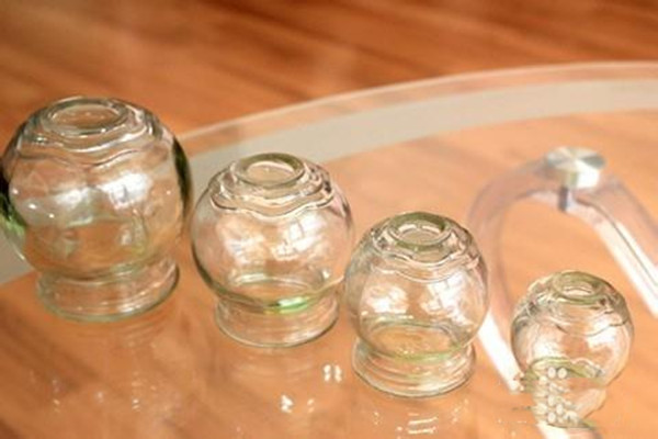 拔罐是如何達(dá)到減肥效果的 拔罐減肥需要控制飲食嗎 拔罐是如何達(dá)到減肥效果的 拔罐減肥需要控制飲食嗎