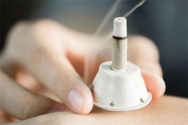 艾灸減肥可以天天做嗎 艾灸減肥幾天灸一次最好 艾灸減肥可以天天做嗎 艾灸減肥幾天灸一次最好