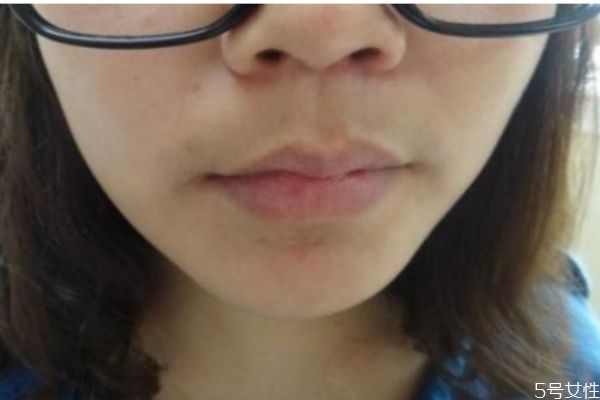 女性造成唇毛的原因是什么 為什么女性會(huì)長(zhǎng)唇毛 女性造成唇毛的原因是什么 為什么女性會(huì)長(zhǎng)唇毛