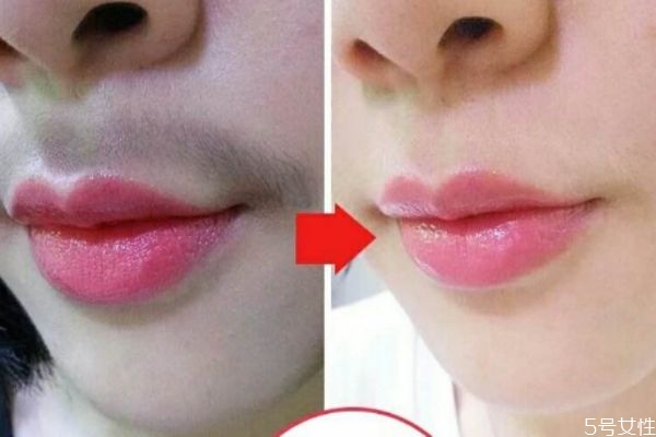女性造成唇毛的原因是什么 為什么女性會(huì)長(zhǎng)唇毛 女性造成唇毛的原因是什么 為什么女性會(huì)長(zhǎng)唇毛