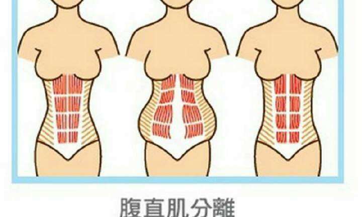 腹直肌怎么練 鍛煉腹直肌的方法
