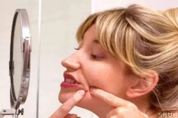 去痘痘可以用手擠嗎 手可以擠痘痘嗎 去痘痘可以用手擠嗎 手可以擠痘痘嗎