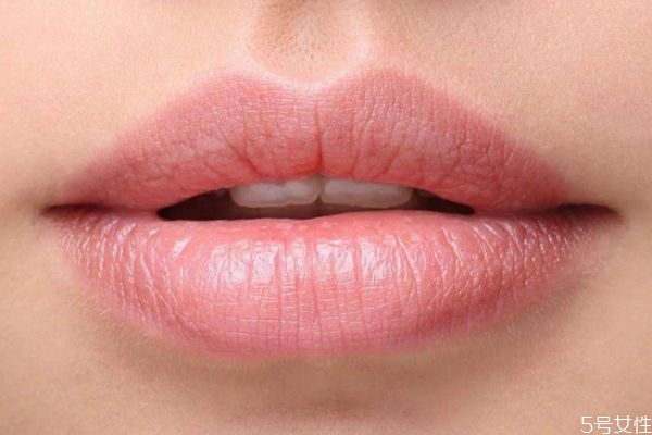 嘴唇發(fā)黑是怎么回事 嘴唇顏色為什么會變黑 嘴唇發(fā)黑是怎么回事 嘴唇顏色為什么會變黑