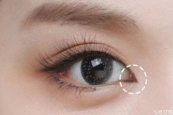 眼距寬怎么改善 怎樣改善眼距過(guò)寬 眼距寬怎么改善 怎樣改善眼距過(guò)寬