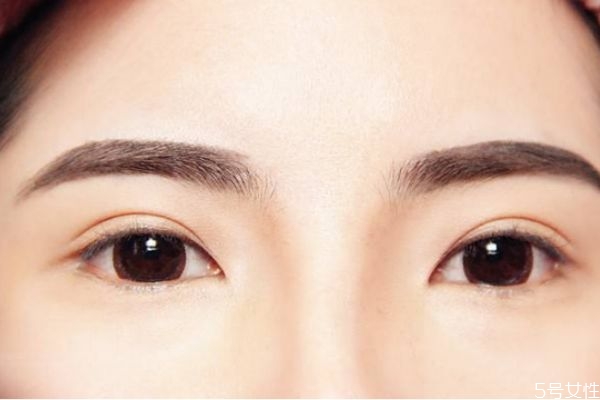 眼距寬怎么改善 怎樣改善眼距過(guò)寬 眼距寬怎么改善 怎樣改善眼距過(guò)寬