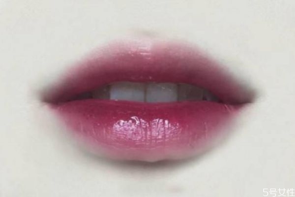 嘴唇發(fā)黑是怎么回事 嘴唇顏色為什么會變黑 嘴唇發(fā)黑是怎么回事 嘴唇顏色為什么會變黑