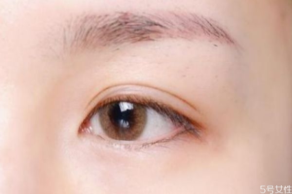 眼角細紋嚴重怎么辦 眼角的細紋怎么引起的 眼角細紋嚴重怎么辦 眼角的細紋怎么引起的