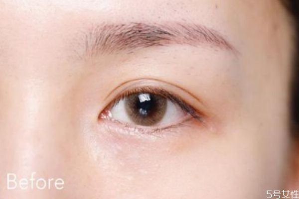 眼角細紋嚴重怎么辦 眼角的細紋怎么引起的 眼角細紋嚴重怎么辦 眼角的細紋怎么引起的