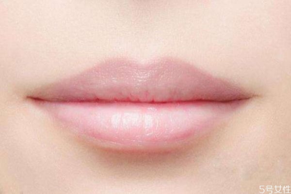嘴唇發(fā)黑是怎么回事 嘴唇顏色為什么會變黑 嘴唇發(fā)黑是怎么回事 嘴唇顏色為什么會變黑