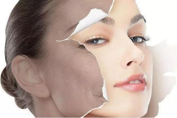 臉上的痘印怎么恢復 臉上留了痘印怎么辦 臉上的痘印怎么恢復 臉上留了痘印怎么辦