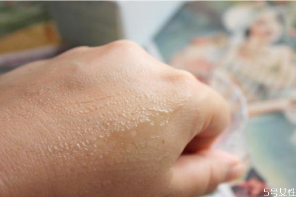 皮膚曬傷蛻皮怎么辦 皮膚曬傷蛻皮怎么修復(fù) 皮膚曬傷蛻皮怎么辦 皮膚曬傷蛻皮怎么修復(fù)