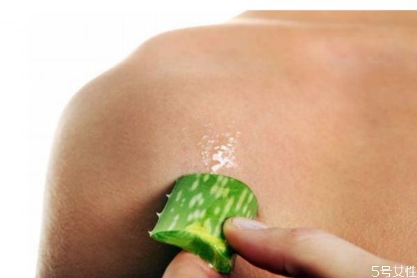 皮膚曬傷蛻皮怎么辦 皮膚曬傷蛻皮怎么修復(fù) 皮膚曬傷蛻皮怎么辦 皮膚曬傷蛻皮怎么修復(fù)