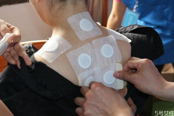 三伏貼什么時(shí)候貼最好 什么時(shí)候最適合貼三伏貼 三伏貼什么時(shí)候貼最好 什么時(shí)候最適合貼三伏貼