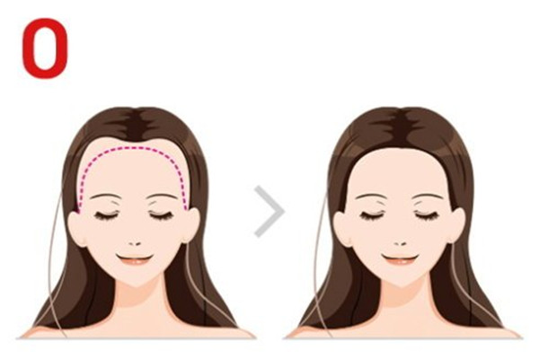 自體毛發(fā)種植的原理 自體毛發(fā)種植的特點(diǎn)