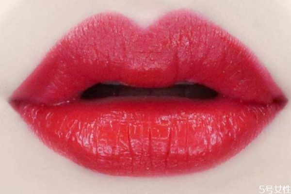 嘴皮干燥起皮是缺什么 嘴皮干燥起皮是什么原因 嘴皮干燥起皮是缺什么 嘴皮干燥起皮是什么原因