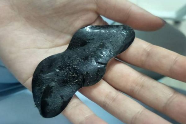 黑頭貼的使用方法 黑頭貼應(yīng)該怎么使用 黑頭貼的使用方法 黑頭貼應(yīng)該怎么使用