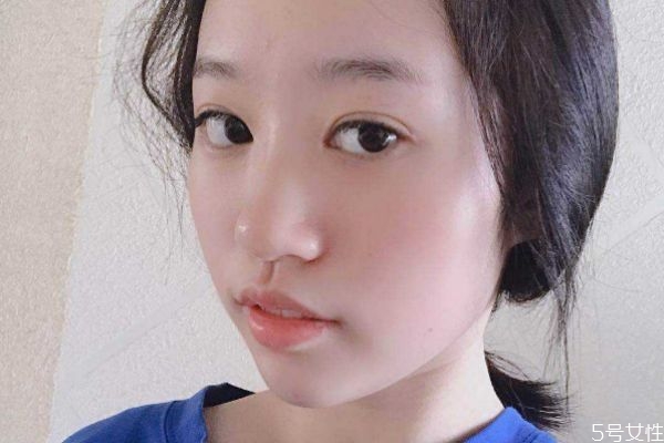 玻尿酸隆鼻后的注意事項(xiàng) 玻尿酸隆鼻后怎么護(hù)理 玻尿酸隆鼻后的注意事項(xiàng) 玻尿酸隆鼻后怎么護(hù)理