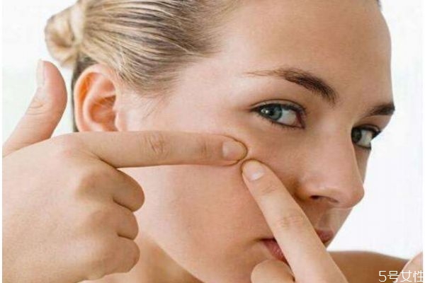 吃辣長痘還是吃糖長痘 吃什么最長痘 吃辣長痘還是吃糖長痘 吃什么最長痘