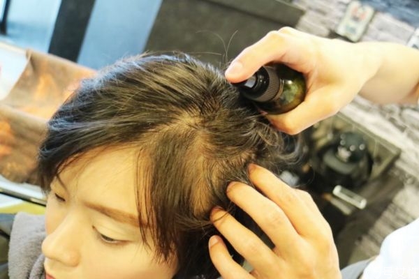 頭皮染到顏色怎么辦 頭皮染到顏色怎么解決 頭皮染到顏色怎么辦 頭皮染到顏色怎么解決