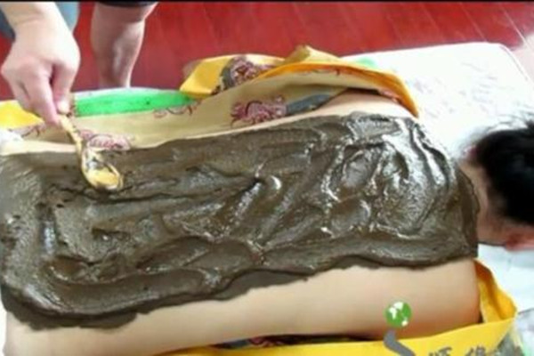 泥灸可以敷哪些部位 泥灸的分類 泥灸可以敷哪些部位 泥灸的分類