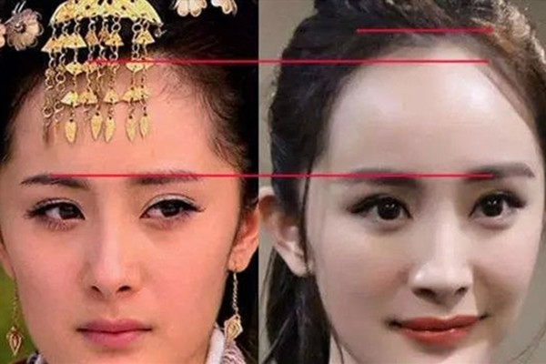 發(fā)際線可以自行恢復(fù)嗎 發(fā)際線后移的原因 發(fā)際線可以自行恢復(fù)嗎 發(fā)際線后移的原因