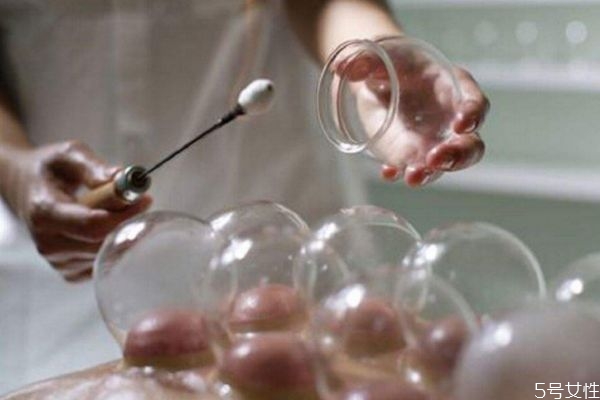 拔罐出水泡怎么回事 為什么拔罐會(huì)出水泡 拔罐出水泡怎么回事 為什么拔罐會(huì)出水泡